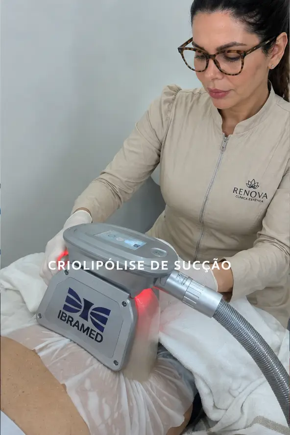 Sessão de criolipólise de sucção com equipamento na Renova em Sorocaba